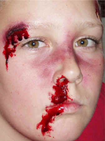 Special_Effects_BloodiedBrowCut2.JPG (100671 bytes)